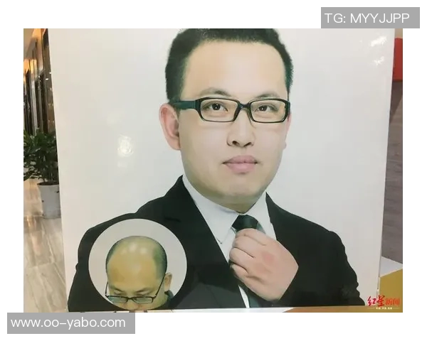 霍华德调侃布朗发际线问题推荐Tony助力解决秃顶烦恼